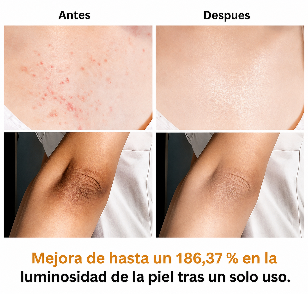 Veilosy Peel Shot - Spray exfoliante corporal con ácido kójico y cúrcuma