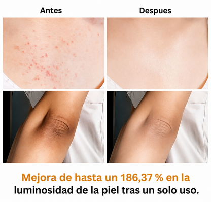 Veilosy Peel Shot - Spray exfoliante corporal con ácido kójico y cúrcuma